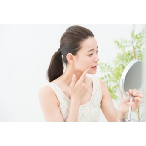 セレックシステム